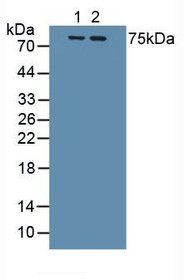Western Blot; Sample: Lane1: Human Lung Tissue; Lane2: Human A549 Cells.