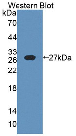 Western Blot; Sample: Recombinant protein.