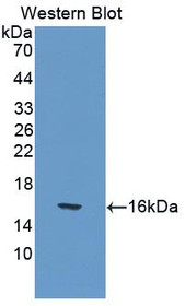 Western Blot; Sample: Recombinant protein.