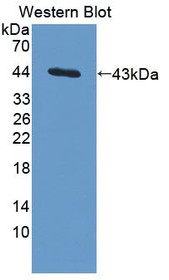 Western Blot; Sample: Recombinant protein.