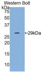 Western Blot; Sample: Recombinant protein.