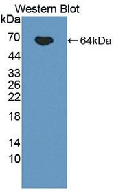 Western Blot; Sample: Recombinant protein.