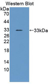 Western Blot; Sample: Recombinant protein.
