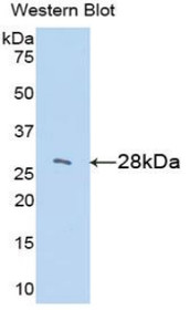 Western Blot; Sample: Recombinant protein.