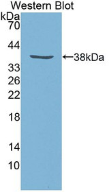 Western Blot; Sample: Recombinant protein.
