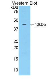Western Blot; Sample: Recombinant protein.