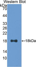 Western Blot; Sample: Recombinant protein.
