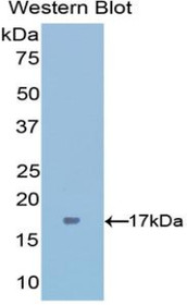 Western Blot; Sample: Recombinant protein.
