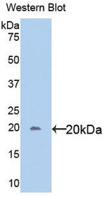 Western Blot; Sample: Recombinant protein.