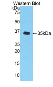 Western Blot; Sample: Recombinant protein.