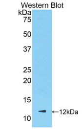 Western Blot; Sample: Recombinant protein.