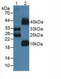 Western Blot; Lane1: Mouse Lung Tissue; Lane2: Mouse Testis Tissue.