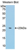 Western Blot; Sample: Recombinant protein.