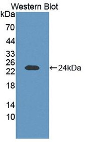 Western Blot; Sample: Recombinant protein.