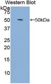 Western Blot; Sample: Recombinant protein.