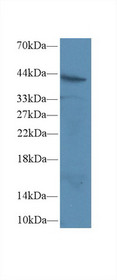 Western Blot; Sample: Human Jurkat cell lysate; Primary Ab: 2µg/ml Rabbit Anti-Rat FAS Antibody Second Ab: 0.2µg/mL HRP-Linked Caprine Anti-Rabbit IgG Polyclonal Antibody