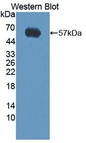 Western Blot; Sample: Recombinant protein.