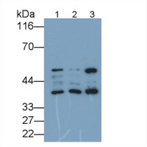 Western Blot; Sample: Recombinant protein.