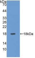 Western Blot; Sample: Recombinant SELE, Human.