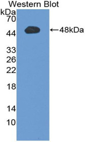 Western Blot; Sample: Recombinant protein.