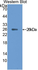 Western Blot; Sample: Recombinant protein.