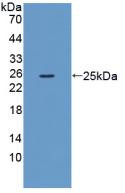 Western Blot; Sample: Recombinant XCR1, Mouse.