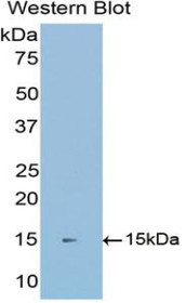 Western Blot; Sample: Recombinant protein.