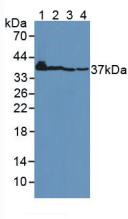 Western Blot; Sample: Lane1: Mouse Heart Tissue; Lane2: Rat Heart Tissue; Lane3: Mouse Brain Tissue; Lane4: Rat Brain Tissue.