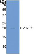 Western Blot; Sample: Recombinant ANGPT1, Mouse.