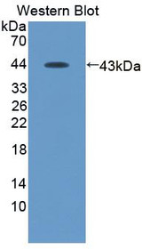 Western Blot; Sample: Recombinant protein.
