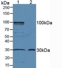 Western Blot; Sample: Lane1: Mouse Liver Tissue; Lane2: Mouse Skin Tissue.