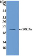Western Blot; Sample: Recombinant ACE, Human.