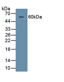Corneodesmosin (CDSN) Polyclonal Antibody, CAU29049