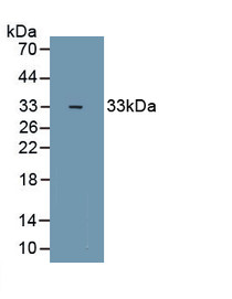 Zinc Finger Homeobox Protein 1B (ZFHX1B) Polyclonal Antibody, CAU29052
