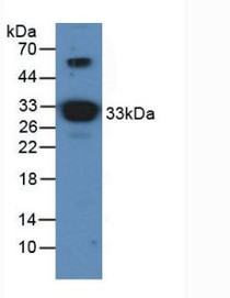 Western Blot; Sample: Mouse Brain Tissue.