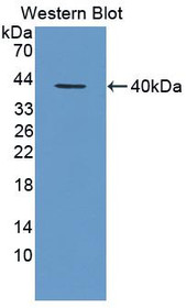 Western Blot; Sample: Recombinant protein.