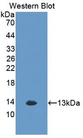 Western Blot; Sample: Recombinant protein.