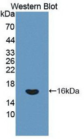 Western Blot; Sample: Recombinant protein.