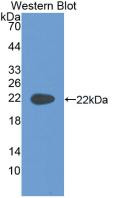 Western Blot;Sample: Recombinant KRT4, Rat.