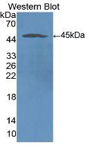Western Blot ;Sample: Recombinant ICAM1, Human.