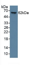 Western Blot; Sample: Human Lung Tissue.