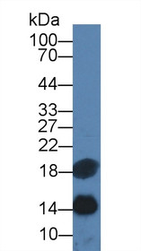 Western Blot; Sample: Rat Pancreas lysate; Primary Ab: 2µg/ml Mouse Anti-Rat TFF2 Antibody Second Ab: 0.2µg/mL HRP-Linked Caprine Anti-Mouse IgG Polyclonal Antibody