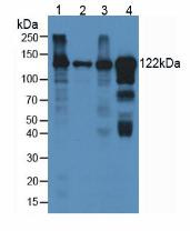 Western Blot