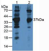 Western Blot; Sample: Lane1: Rat Brain Tissue; Lane2: Human Jurkat Cells.