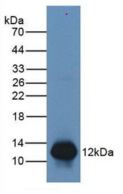 Western Blot; Sample: Human Leukocytes Cells.