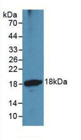 Western Blot; Sample: Recombinant ADAMTS1, Human.