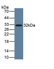 Figure 1. Western Blot Sample Human Lung Tissue<br/>Second Ab: 1:5000 Dilution of HRP-Linked Rabbit Anti-Mouse IgG Ab
