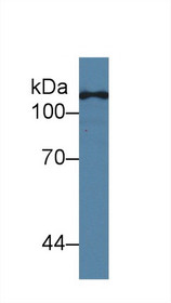 Western Blot; Sample: Human Hela cell lysate; Primary Ab: 2µg/ml Mouse Anti-Human TLR5 Antibody Second Ab: 0.2µg/mL HRP-Linked Caprine Anti-Mouse IgG Polyclonal Antibody