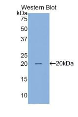 Western Blot;Sample: Recombinant Surv, Human.