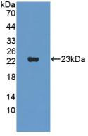 Western Blot; Sample: Recombinant SVIL, Human.